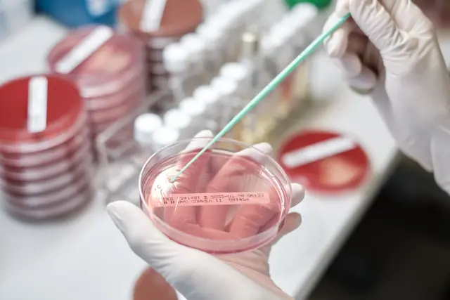 Behandschuhte Hände beimpfen eine Petrischale im mikrobiologischen Labor einer Klinik